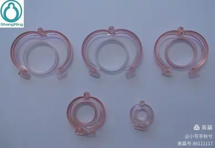 浅谈包皮商环切除的优点